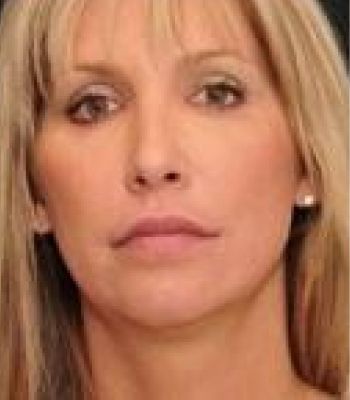 Female with shoulder-length blonde hair, serious expression.